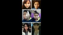 Koreanische Plastische Chirurgie Vor Und Nach Fotos