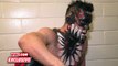 Finn Bálor feels the effects of his battle with Samoa Joe: April 1, 2016