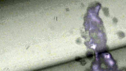 Chpts France bt court comme ma bite