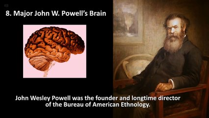10 Most Famous Preserved Body Parts