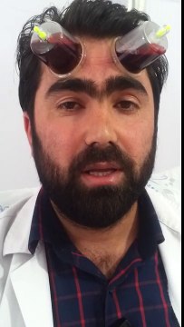 BAŞ VE YÜZE HACAMAT NASIL YAPILIR. VAN HACAMAT VE SÜLÜK TEDAVİ MERKEZİ 0532 172 15 66 - YouTube