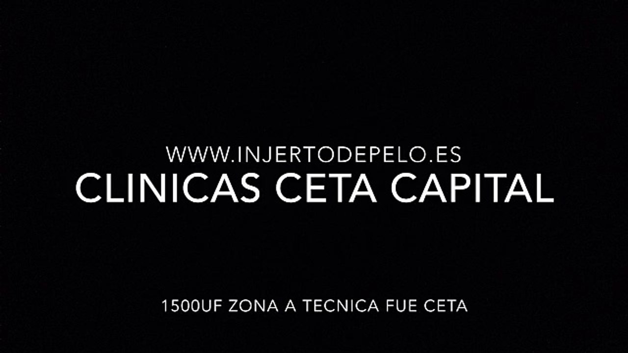CLINICAS CETA CAPITAL www.injertodepelo.es