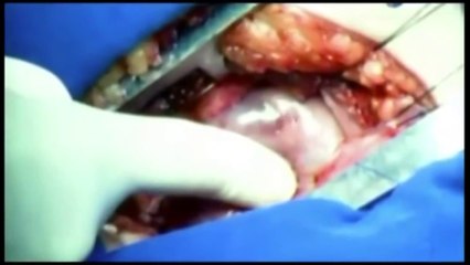 documental Discovery Channel sobre células madre (tusCelulasMadre.info)