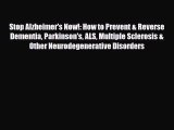 Read ‪Stop Alzheimer's Now!: How to Prevent & Reverse Dementia Parkinson's ALS Multiple Sclerosis‬