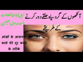 aankhon ke gird siah halqe blackness around eyes