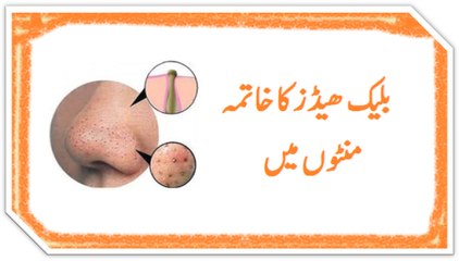 black heads on nose removal