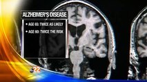 Report: Number of Women with Alzheimer's Doubles Men With Disease