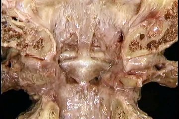 anatomy of head n neck