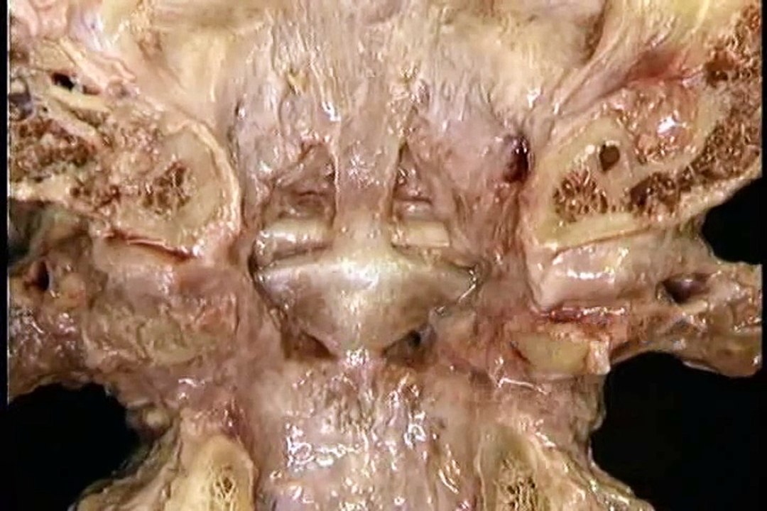 anatomy of head n neck