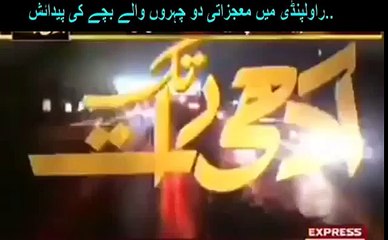 Miraculous Baby Birth of two faces in Rawalpindi Pakistan.