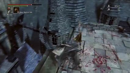 Почему носить конусовидные шлемы плохая идея