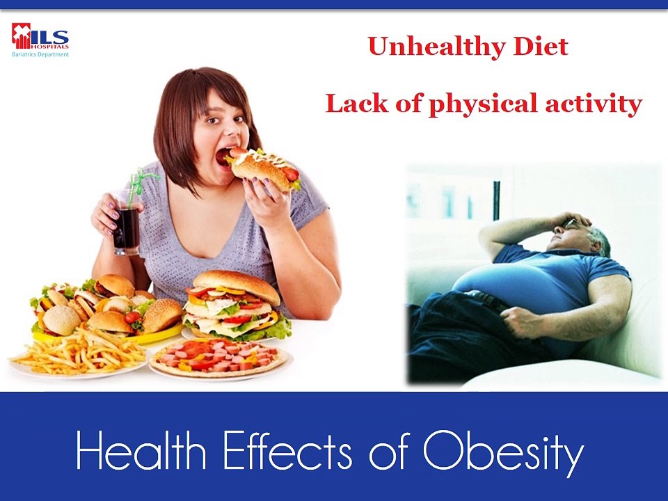 Laparoscopic Obesity Surgery is the best method to overcome obesity