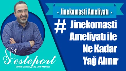 Jinekomasti ile Vücuttan Ne Kadar Yağ Alınır ?