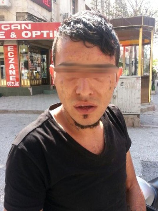 Otobüs Duraklarına 'Fuhuş' Kartviziti Atan Kişi Tutuklandı