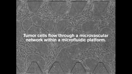 Watching tumors burst through a blood vessel
