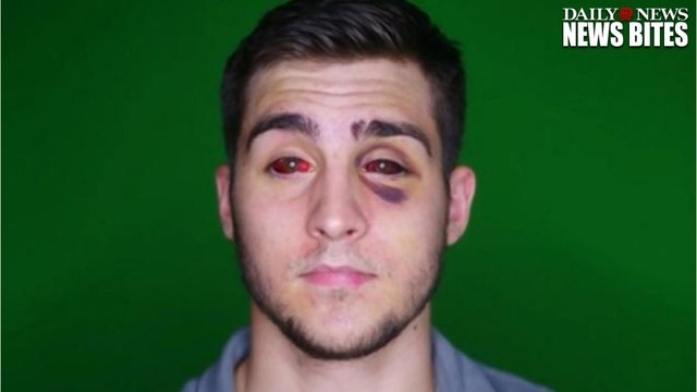 Student Arrested And Choked Unconscious By Undercover Officers Files Lawsuit