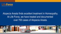 Horrible Hair Loss & Large Patches of Alopecia Areata Case Treated at Life Force