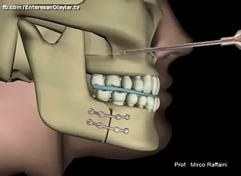 Adamlar Kendilerini Aşmış Aga