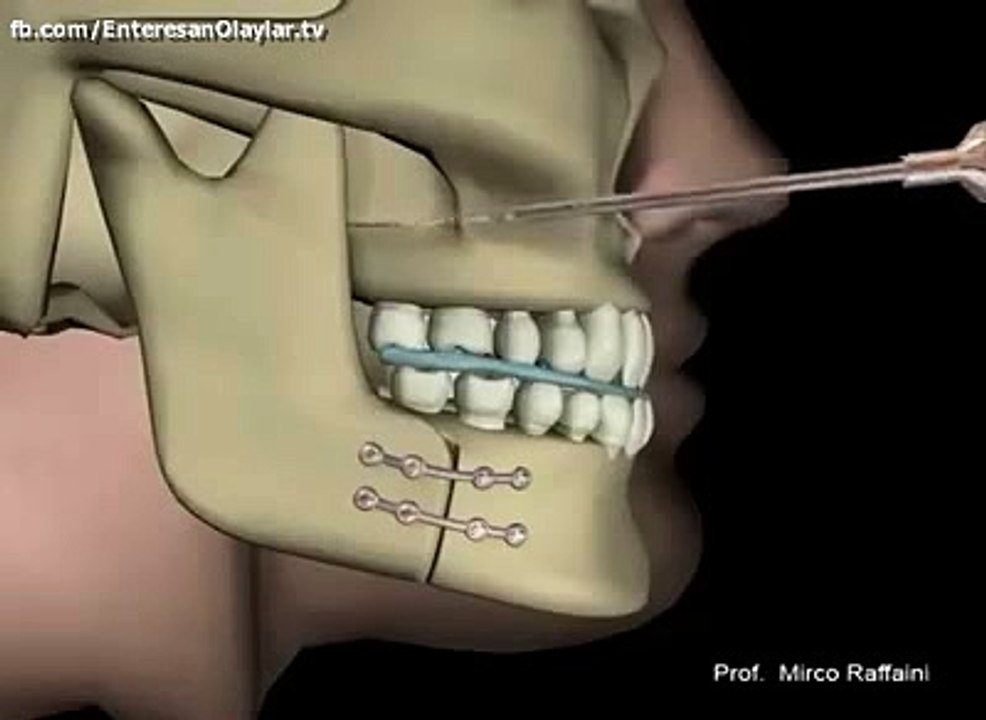 Adamlar Kendilerini Aşmış Aga