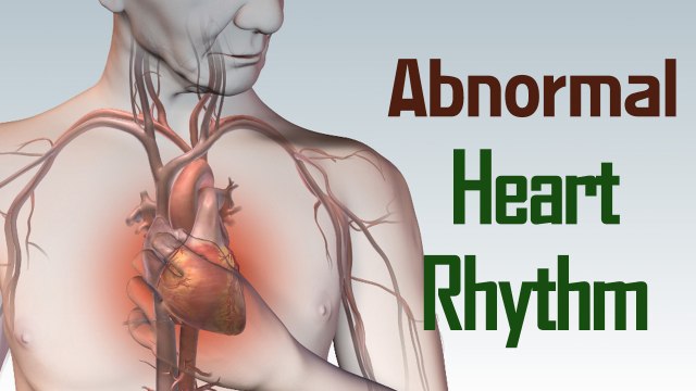 Heart Disease and Abnormal Heart Rhythm (Arrhythmia) Symptoms and Causes