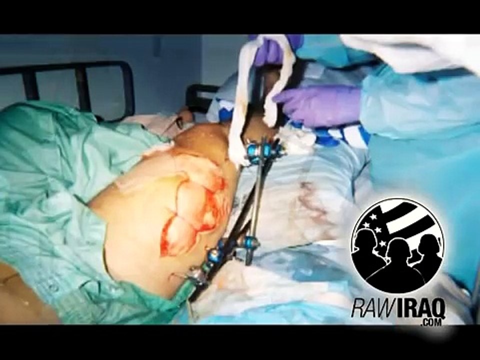Raw Iraq Crazy Footage Warning!!!!!!   RawIraq.com