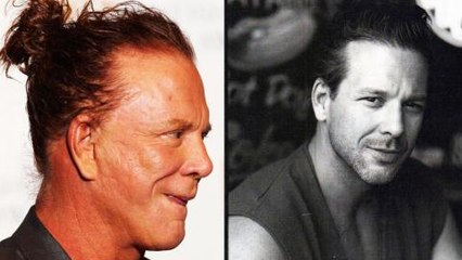 Top 10 Celebrities with the Worst Plastic Surgery