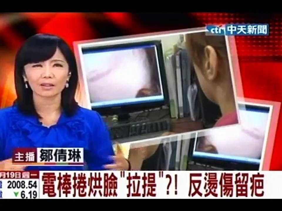電棒捲烘臉拉提？反燙傷留疤