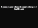 Read Transesophageal Echocardiography for Congenital Heart Disease Ebook Free