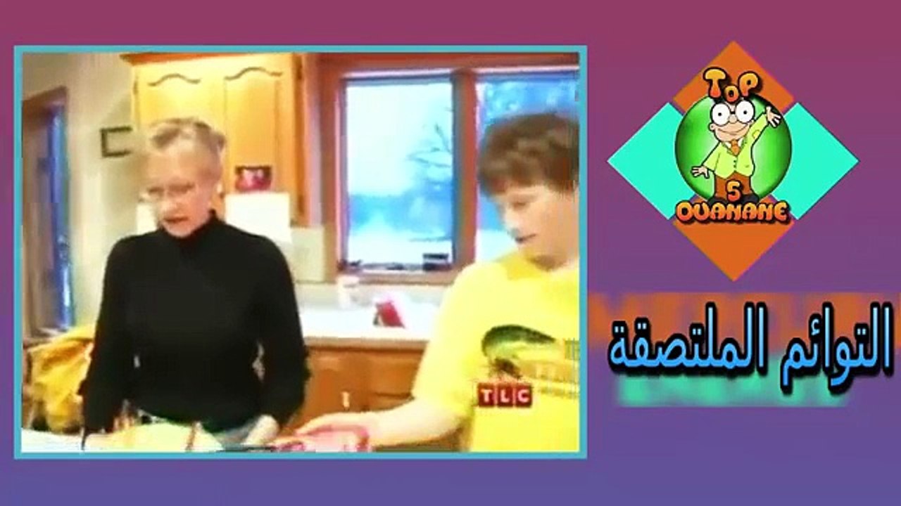 أغرب 5 حالات التوائم الملتصقة فى العالم # متع عقلك