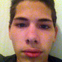 j'ai un appareil dentaire