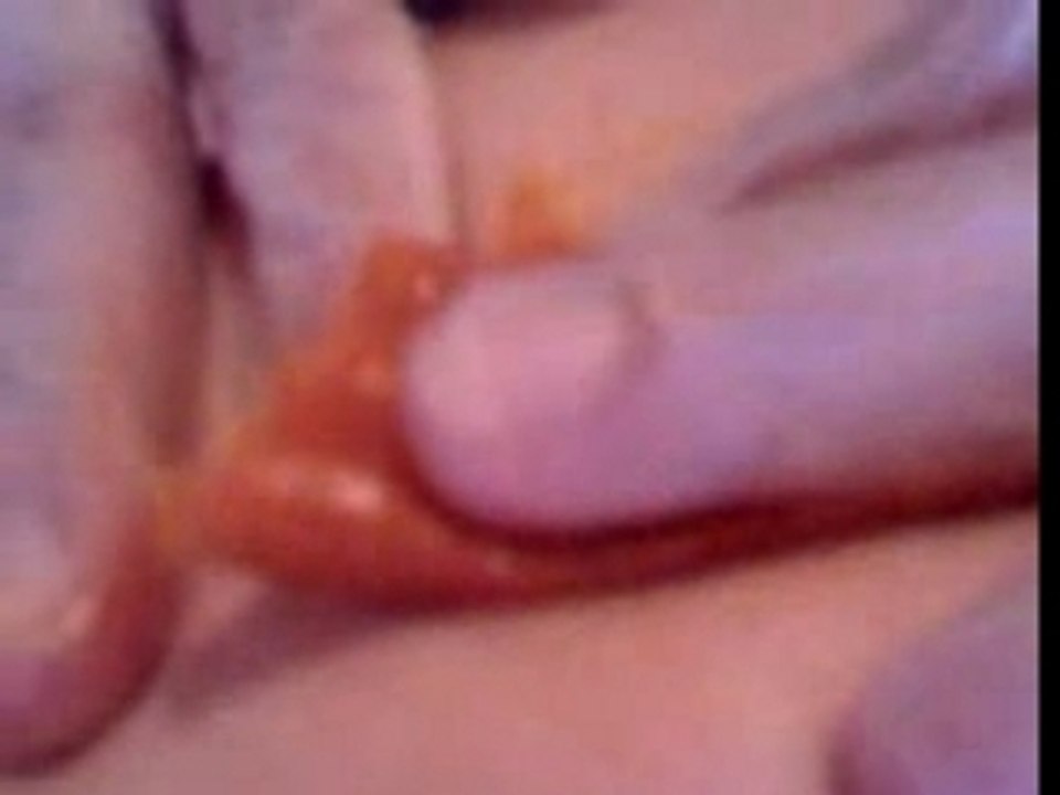 Dr Pepette opère à la maison IV