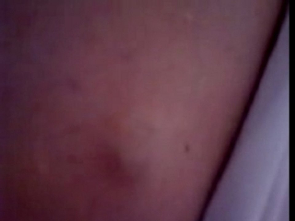 Dr Pepette opère à la maison I