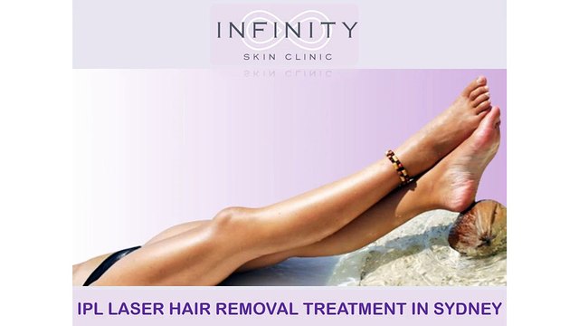 IPL LASER HAIR REMOVAL TREATMENT SYDNEY