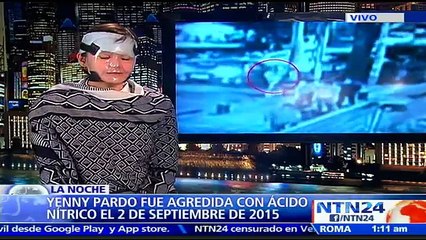 "La agresión con ácido se volvió un crimen de moda": Yenny Marcela Pardo en NTN24