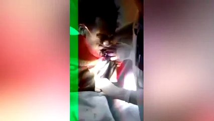 Un médecin retire un poisson encore vivant coincé dans la gorge d'un patient