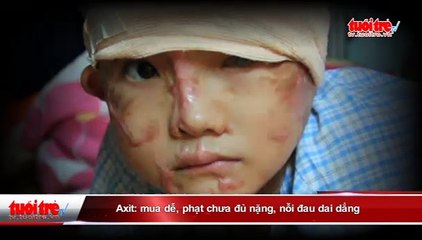 Axit- mua dễ, phạt chưa đủ nặng, nỗi đau dai dẳng...