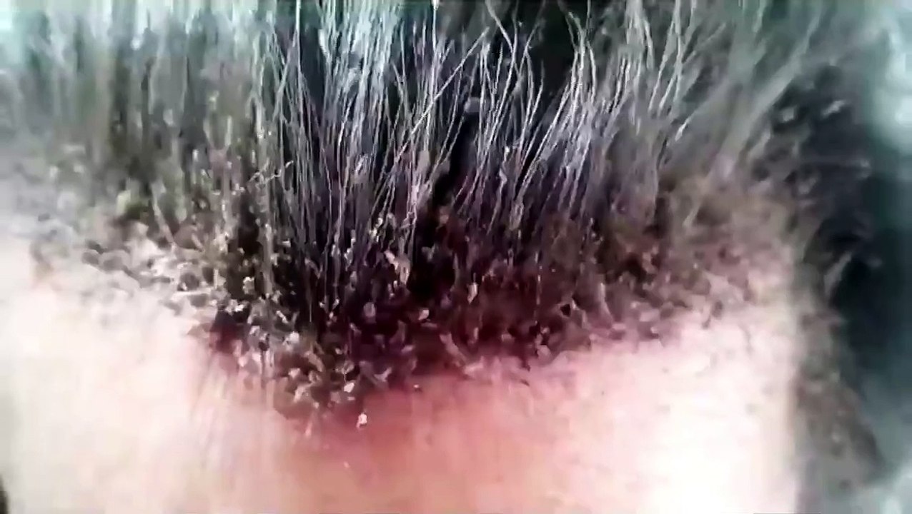 Ecco la testa assurda di quest'uomo