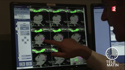 Santé - Prévenir les accidents cardio-vasculaires - 2016/04/14