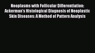 Read Neoplasms with Follicular Differentiation: Ackerman's Histological Diagnosis of Neoplastic