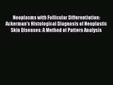 Read Neoplasms with Follicular Differentiation: Ackerman's Histological Diagnosis of Neoplastic