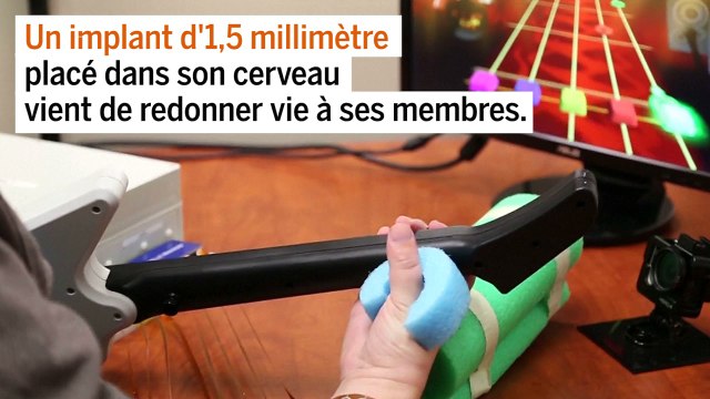 Un tétraplégique retrouve le contrôle de ses bras grâce à un implant placé dans son cerveau