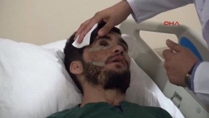 Edirne Yüzü Parçalanan Gence, Bacağındaki Kemik ve Dokudan Çene Yapıldı