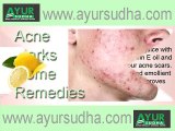 Acne, Rosacea Best Ayurvedic Treatment in India. Top Skin Specialist in Jalandhar, Punjab