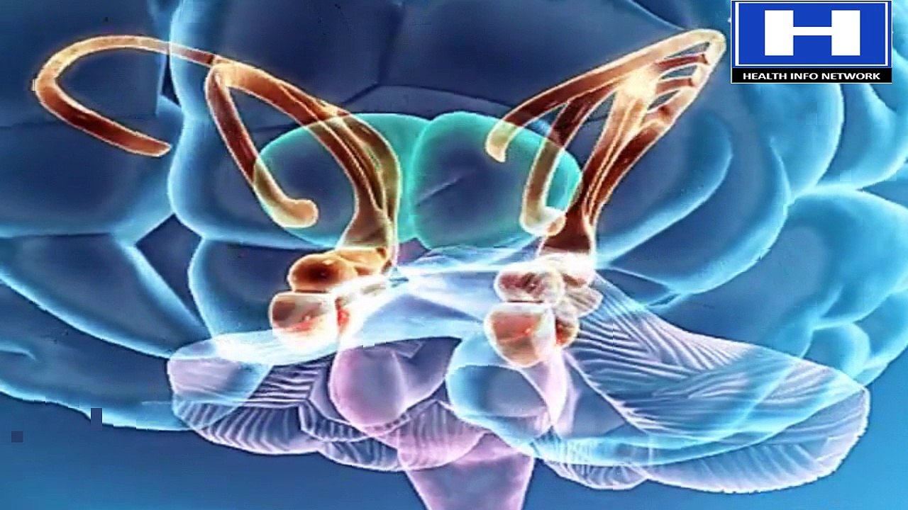 Alzheimer disease pathophysiology, symptoms, causes, stages.