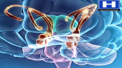 Alzheimer disease pathophysiology, symptoms, causes, stages.
