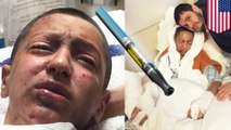 14-year-old kid blinded after vape explodes in his face at NYC mall