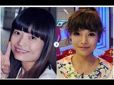 Korean Plastic Surgery Shocking Before And After Photos