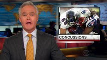 NFL studying rise in concussions