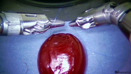 İşte Ameliyatlar Davinci İle Böyle Yapılıyor