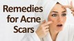 Easy Home Remedies to Get Rid of Acne Scars || Beauty Tips
